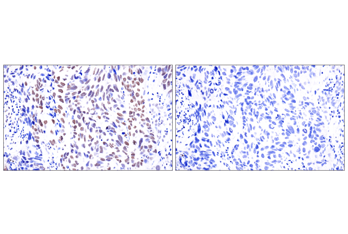 Immunohistochemistry Image 8: Acetyl-Histone H4 (Lys16) (E2B8W) Rabbit Monoclonal Antibody