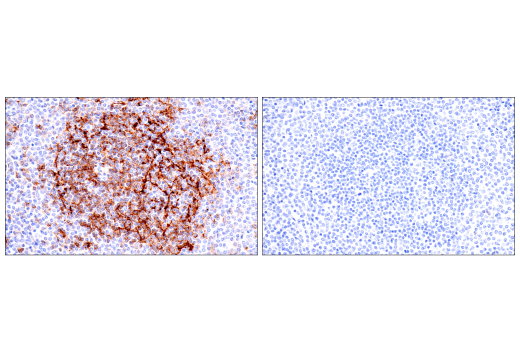 Immunohistochemistry Image 5: CD23 (E1R4G) Rabbit Monoclonal Antibody
