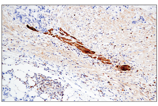 Immunohistochemistry Image 3: Enolase-2 (E2H9X) Rabbit Monoclonal Antibody