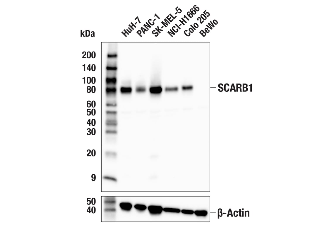 Western Blotting Image 3: SCARB1 (E9H4F) Rabbit Monoclonal Antibody