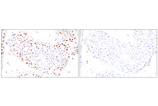 Immunohistochemistry Image 5: PMS2 (M0R4G) Mouse Monoclonal Antibody