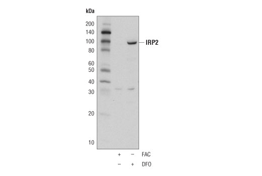 Western Blotting Image 1: IRP2 (D6E6W) Rabbit mAb