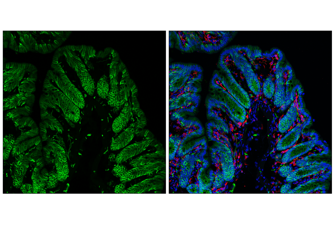 Immunofluorescence Image 2: ALCAM (F3V8Q) Rabbit Monoclonal Antibody