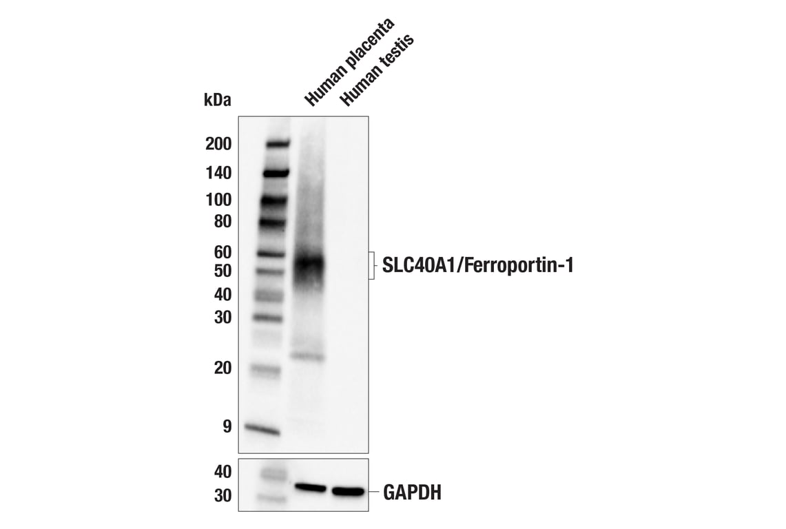Western Blotting Image 2: SLC40A1/Ferroportin-1 (F9U5S) Rabbit Monoclonal Antibody (BSA and Azide Free)