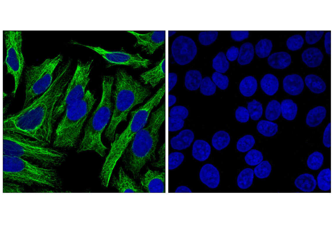 undefined Image 37: Cytokeratin Antibody Sampler Kit