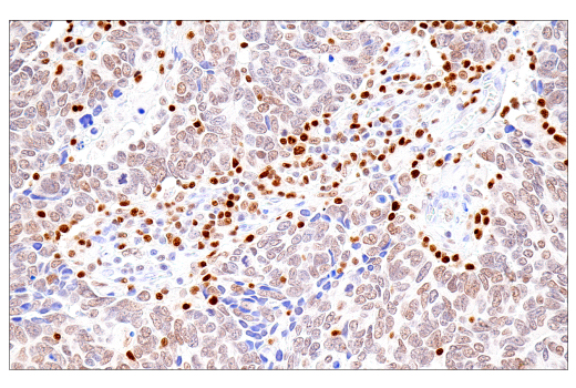 Immunohistochemistry Image 1: RUNX3/AML2 (E8D5W) Rabbit Monoclonal Antibody