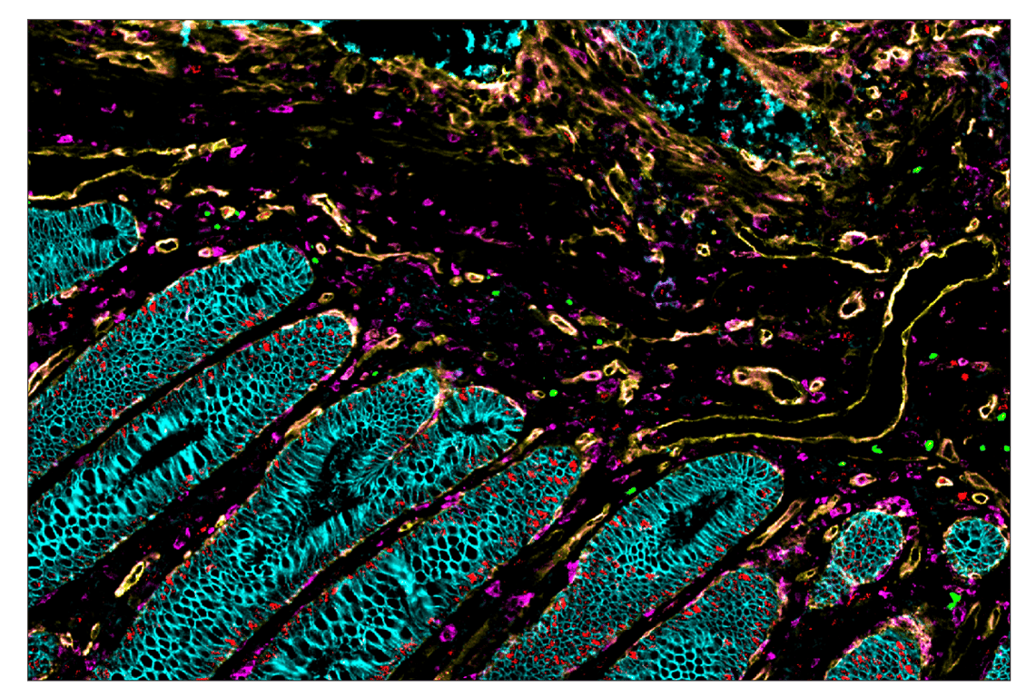 Immunohistochemistry Image 6: Sox10 (E6B6I) & CO-0080-647 SignalStar<sup>™</sup> Oligo-Antibody Pair