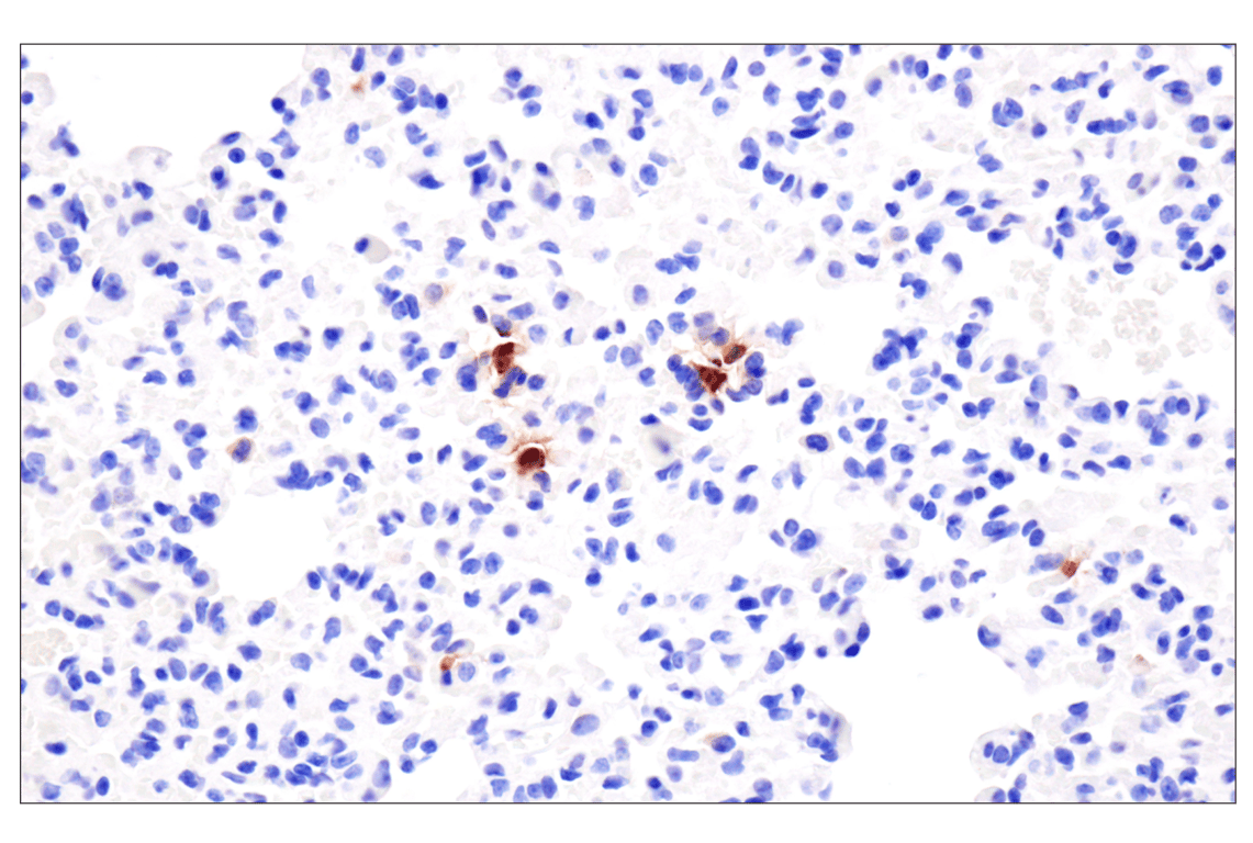 Immunohistochemistry Image 6: Eosinophil cationic protein (F3G7N) Rabbit Monoclonal Antibody (BSA and Azide Free)