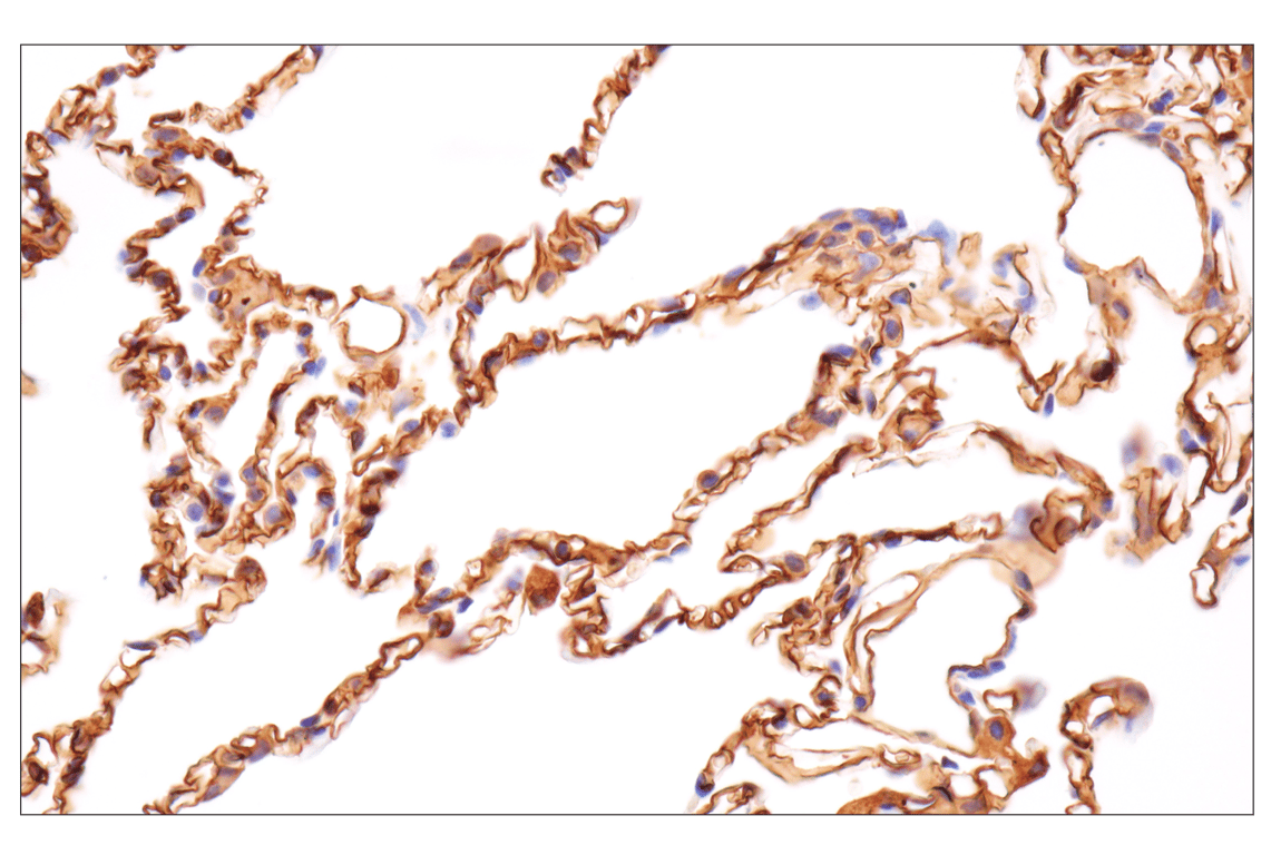 Immunohistochemistry Image 3: CD36 (D8L9T) Rabbit Monoclonal Antibody (BSA and Azide Free)