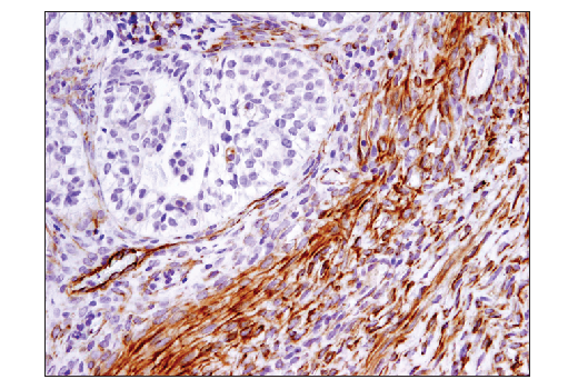 Immunohistochemistry Image 3: SDF1/CXCL12 (D8G6H) Rabbit Monoclonal Antibody (BSA and Azide Free)