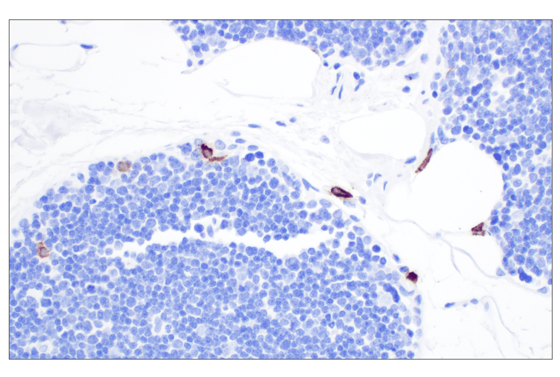 Immunohistochemistry Image 7: Mast Cell Chymase/CMA1 (F6S4Q) Rabbit Monoclonal Antibody