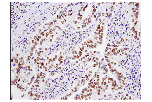 Immunohistochemistry Image 2: TRIM33 (D7U4F) Rabbit Monoclonal Antibody