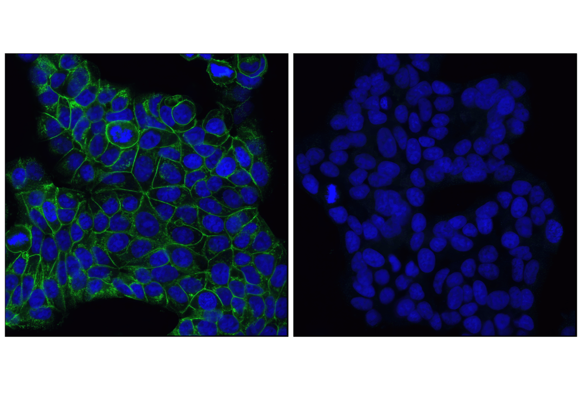 Immunofluorescence Image 1: E-Cadherin (24E10) Rabbit Monoclonal Antibody (BSA and Azide Free)