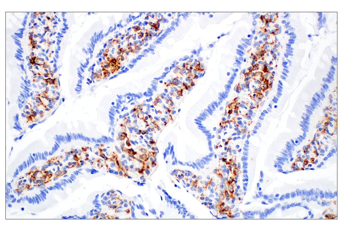 Immunohistochemistry Image 5: CD68 (E3O7V) Rabbit Monoclonal Antibody