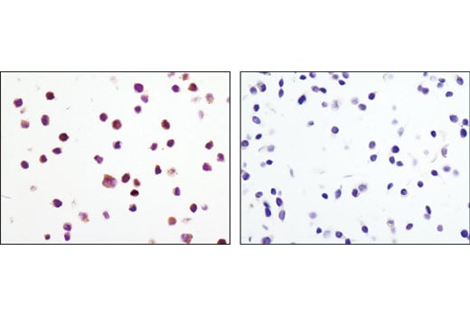 Immunohistochemistry Image 1: Phospho-MEK1/2 (Ser221) (166F8) Rabbit Monoclonal Antibody