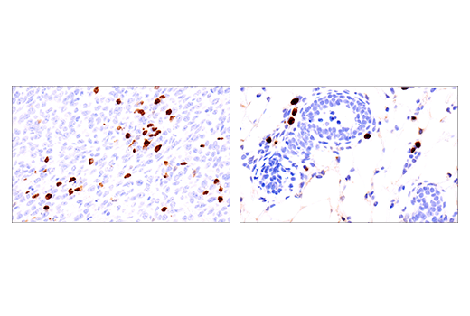 Immunohistochemistry Image 2: S100A8 (E4F8V) Rabbit Monoclonal Antibody