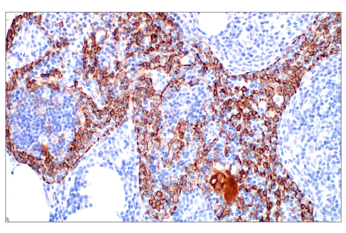 Immunohistochemistry Image 8: Pan-Keratin (Type I) (E6S1S) Rabbit Monoclonal Antibody