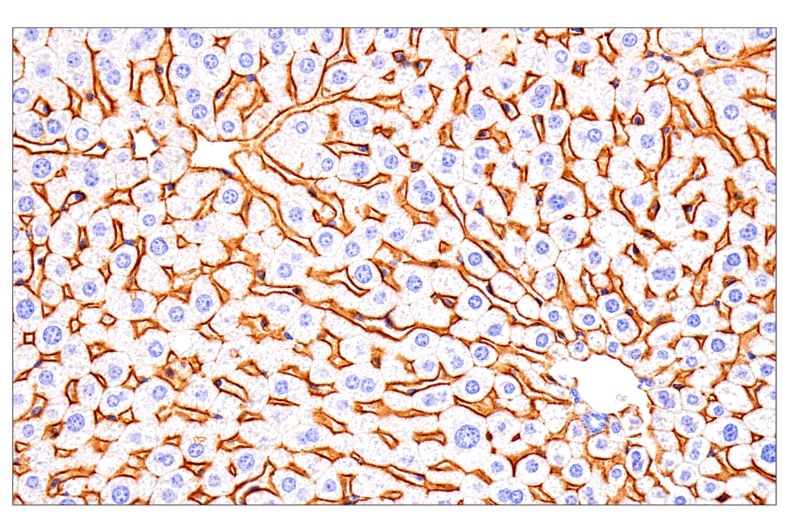 Immunohistochemistry Image 6: SCARB1 (E9H4F) Rabbit Monoclonal Antibody
