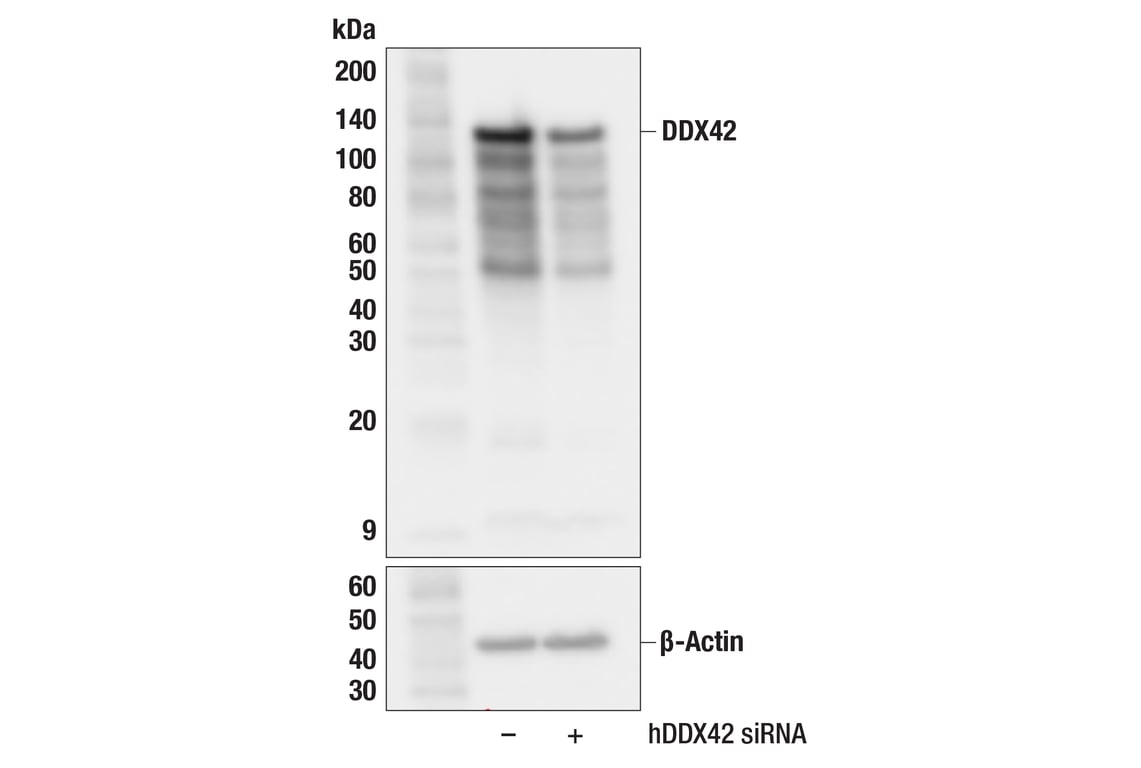 Western Blotting Image 2: DDX42 (F4V2L) Rabbit Monoclonal Antibody