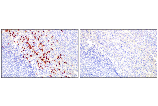 Immunohistochemistry Image 6: MMP-8 (E1C4L) Rabbit Monoclonal Antibody