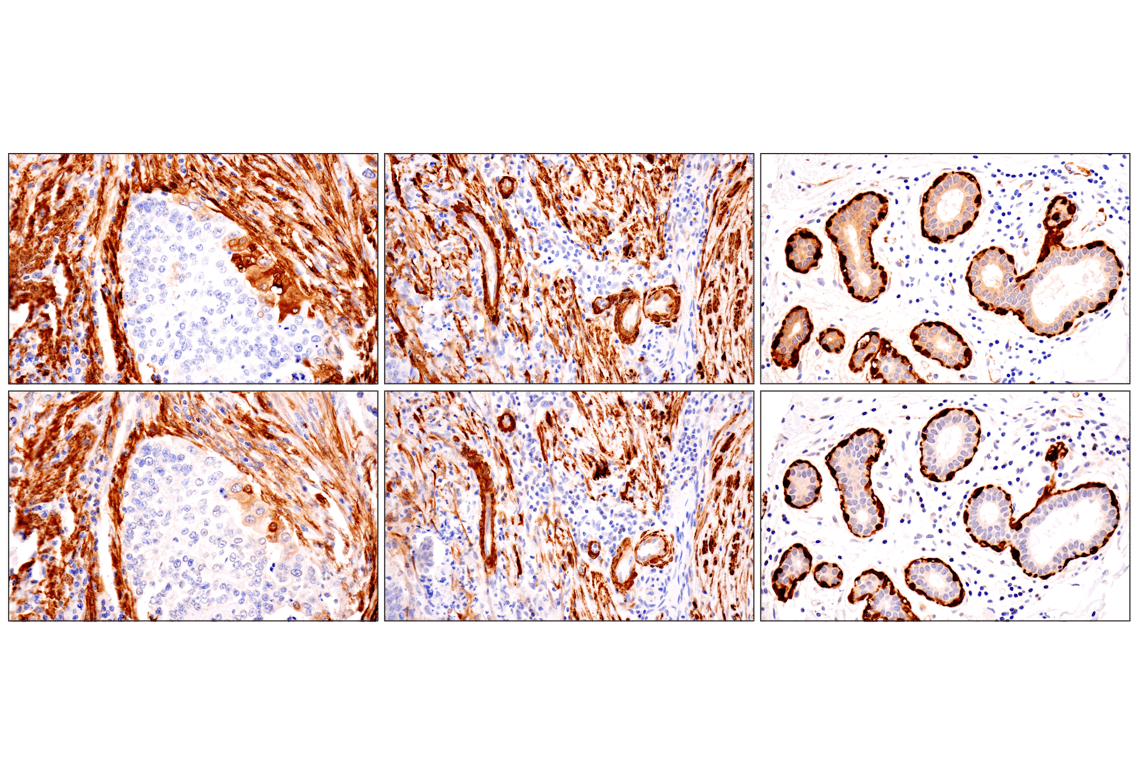 Immunohistochemistry Image 11: Transgelin/TAGLN (F3B7H) Rabbit Monoclonal Antibody