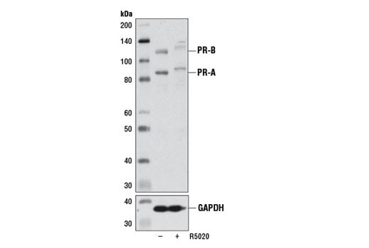 Western Blotting Image 2: Progesterone Receptor A/B (D8Q2J) Rabbit Monoclonal Antibody