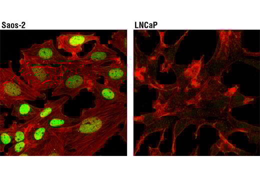 Immunofluorescence Image 1: RUNX2 (D1L7F) Rabbit mAb