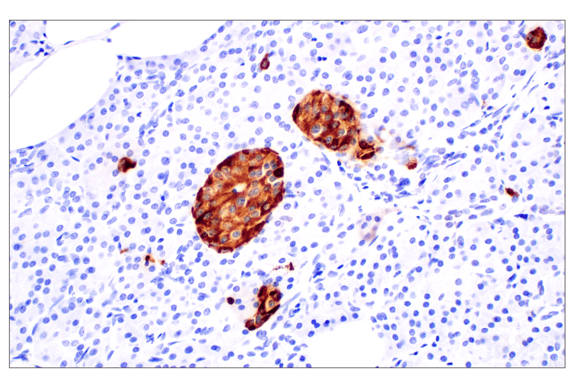 Immunohistochemistry Image 4: CHGA (F7D6H) Rabbit mAb