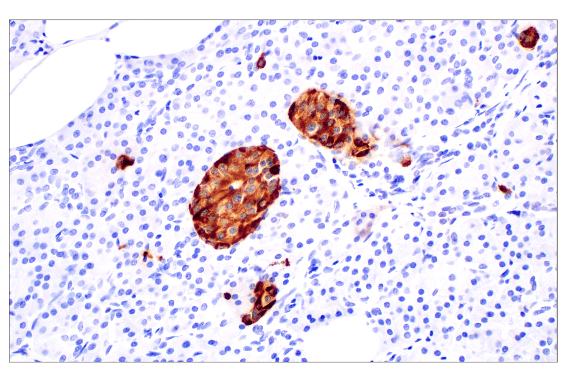 CHGA (F7D6H) Rabbit mAb | Cell Signaling Technology