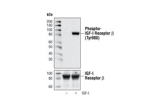 undefined Image 8: Phospho-Insulin/IGF Receptor Antibody Sampler Kit