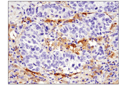 Immunohistochemistry Image 2: GPNMB (E4D7P) Rabbit Monoclonal Antibody