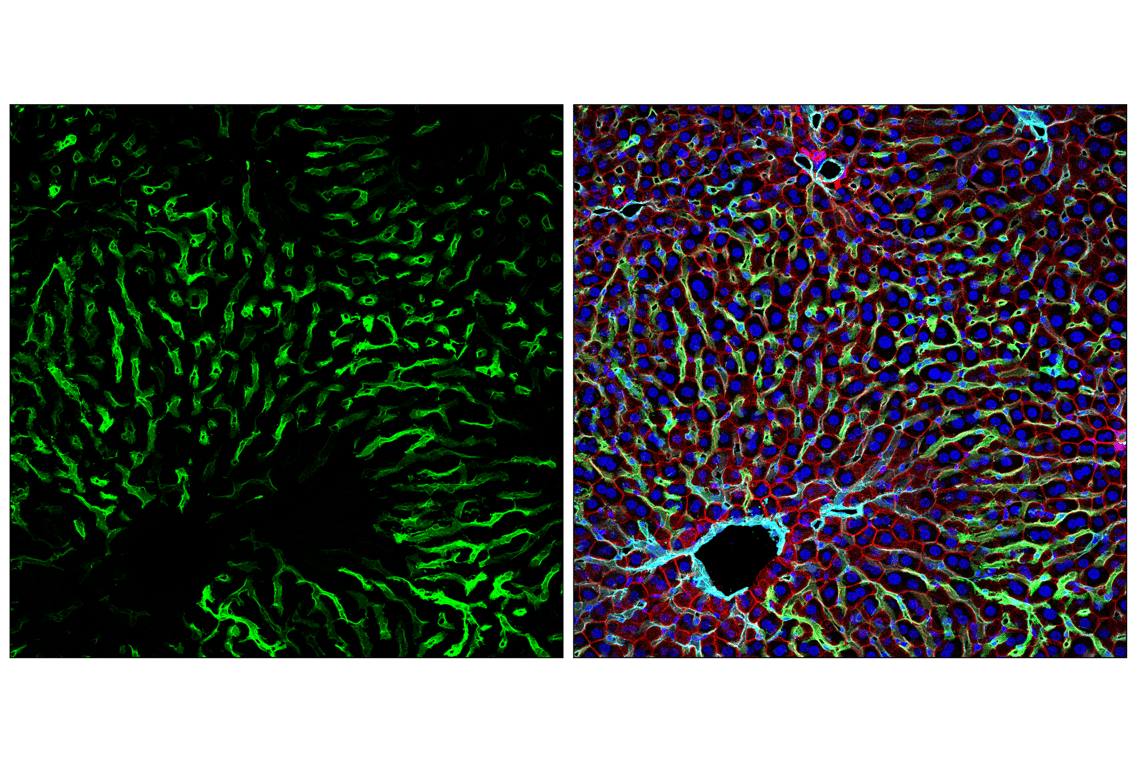 Immunofluorescence Image 2: LYVE-1 (E5P8S) Rabbit Monoclonal Antibody
