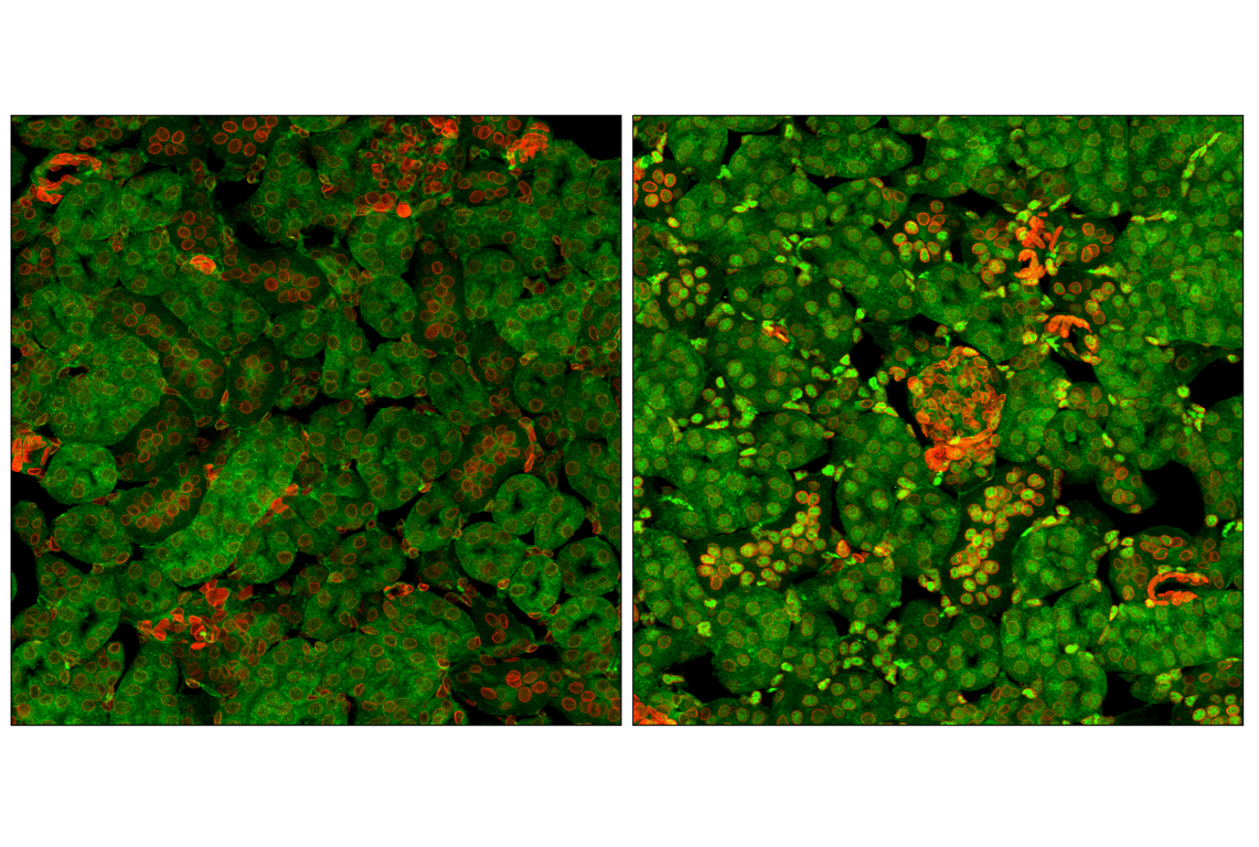 Immunofluorescence Image 1: NF-kappaB p65 (D14E12) Rabbit Monoclonal Antibody (BSA and Azide Free)