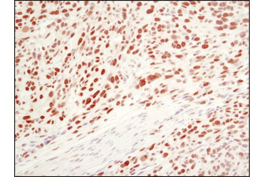Immunohistochemistry Image 4: Ezh2 (D2C9) Rabbit Monoclonal Antibody