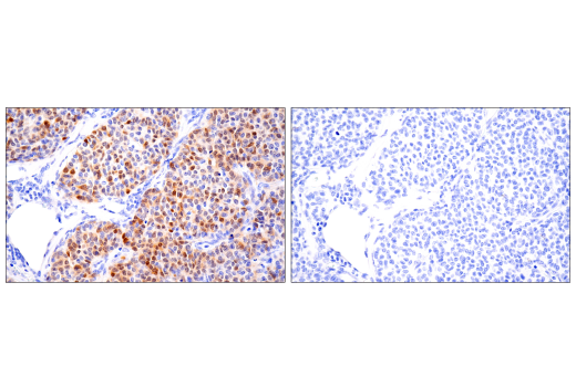 Immunohistochemistry Image 4: S100A1 (4C4.9) Mouse Monoclonal Antibody