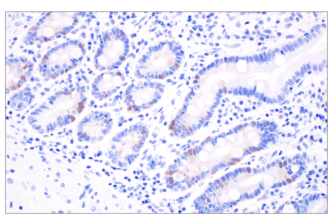 Immunohistochemistry Image 8: Thymidine Kinase 1 (E2H7Z) Rabbit Monoclonal Antibody