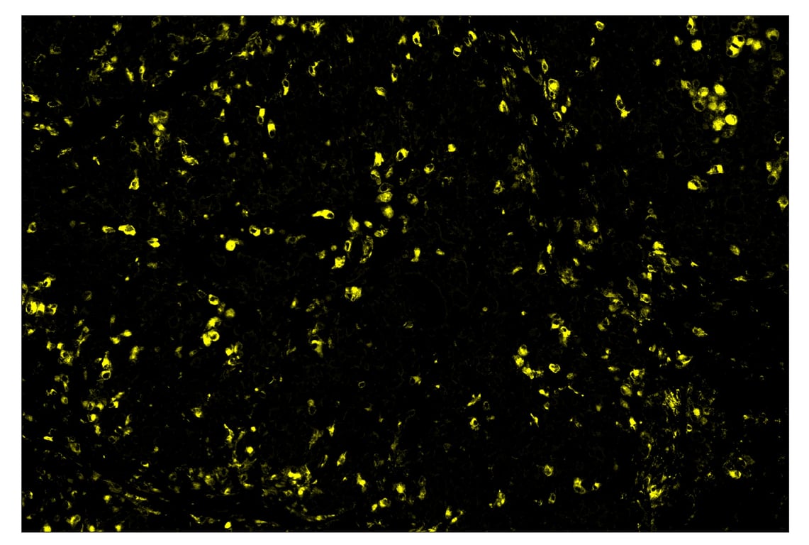 Immunohistochemistry Image 3: CD68 (D4B9C) & CO-0007-647 SignalStar<sup>™</sup> Oligo-Antibody Pair