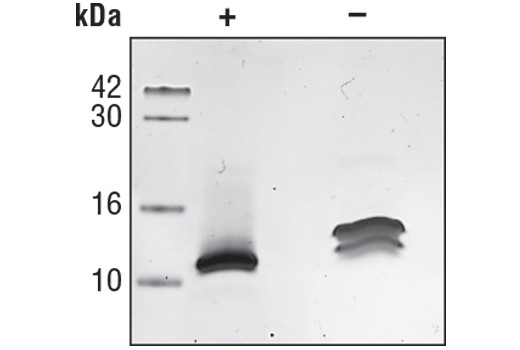 undefined Image 1: Human Interleukin-8 (hIL-8) Recombinant Protein