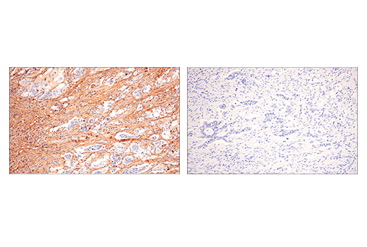 undefined Image 33: ECM Profiling Antibody Sampler Kit
