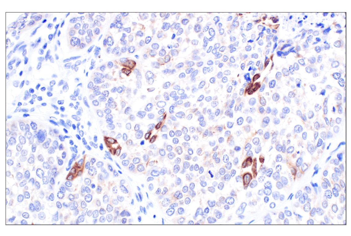 Immunohistochemistry Image 4: MGST1 (F6F5T) Rabbit Monoclonal Antibody