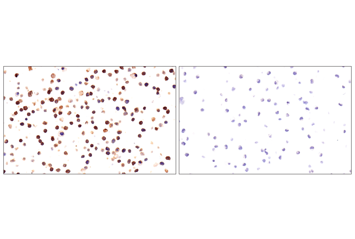 Immunohistochemistry Image 5: CD22 (F9D1W) Rabbit Monoclonal Antibody
