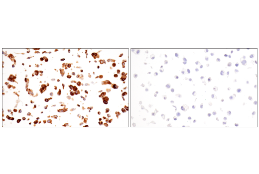 Immunohistochemistry Image 15: alpha-2-Macroglobulin (E6N7X) Rabbit Monoclonal Antibody