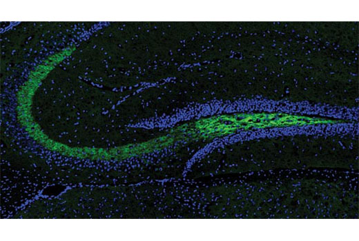 Immunofluorescence Image 1: BACE1 (D10E5) Rabbit Monoclonal Antibody (BSA and Azide Free)
