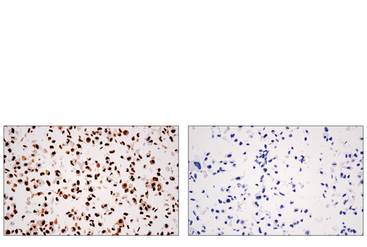 undefined Image 13: PhosphoPlus<sup>®</sup> DNA-PKcs (Ser2056) Antibody Duet