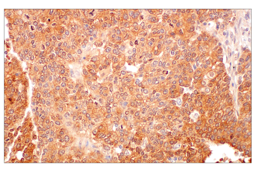 undefined Image 23: Gluconeogenesis Antibody Sampler Kit