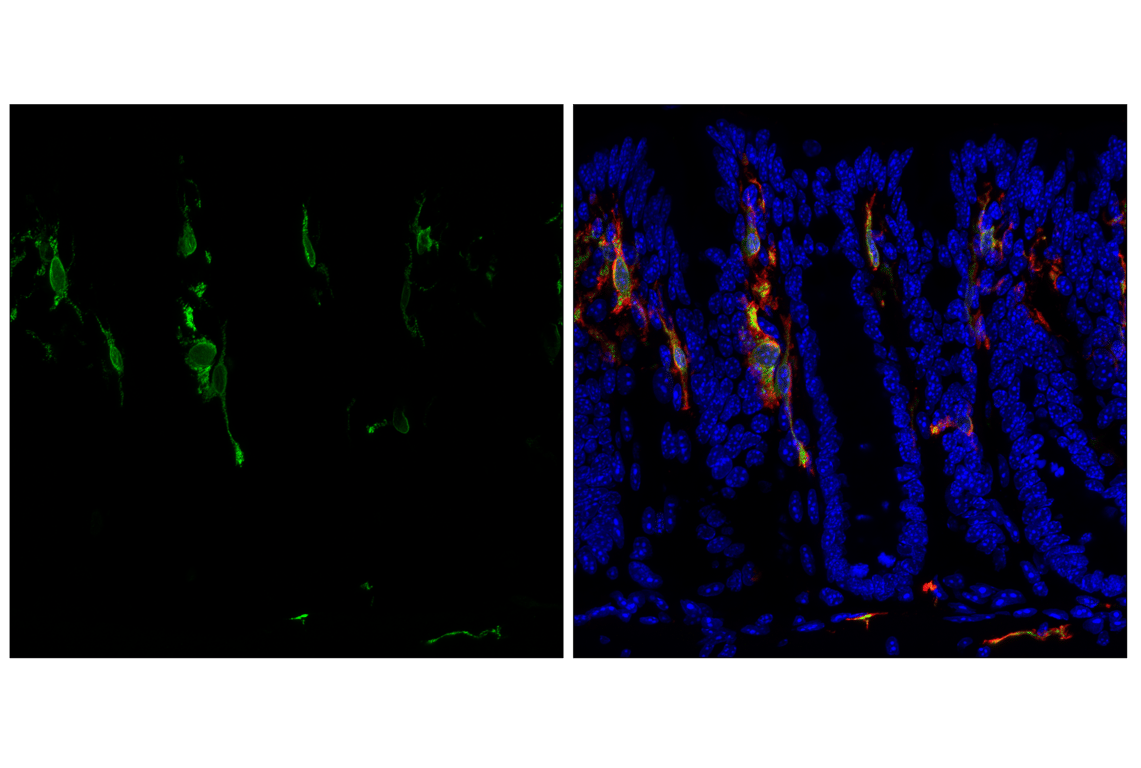 Immunofluorescence Image 4: CD74 (F6K1S) Rabbit Monoclonal Antibody