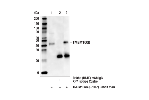 Immunoprecipitation Image 1: TMEM106B (E7H7Z) Rabbit Monoclonal Antibody