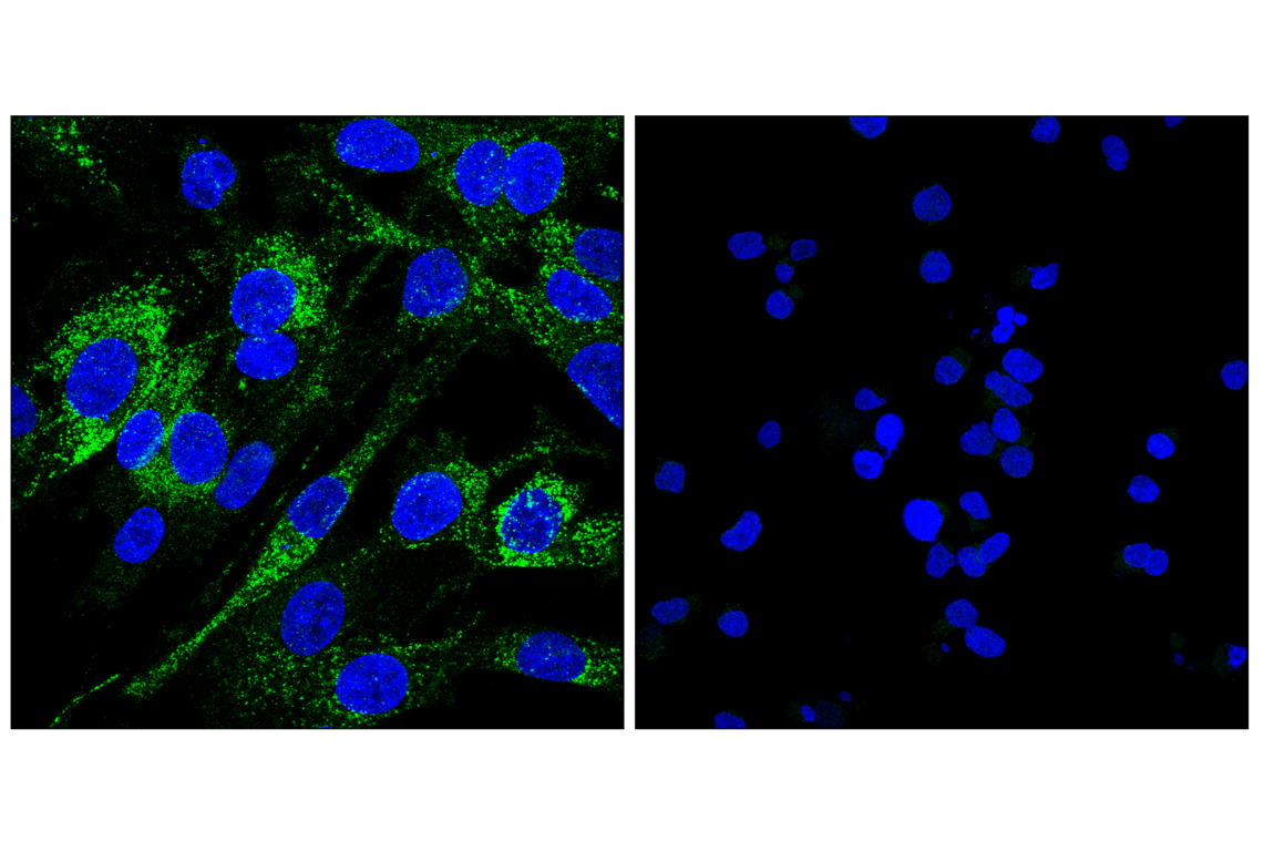 Immunofluorescence Image 1: GP130 (E6X8S) Rabbit Monoclonal Antibody