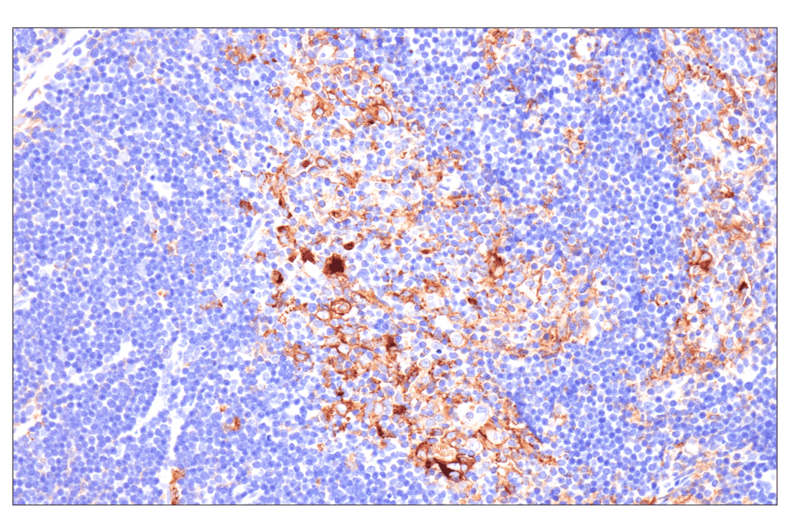 Immunohistochemistry Image 2: MHC Class II (I-E alpha) (F8N7J) Rabbit Monoclonal Antibody