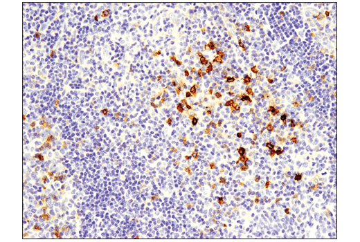 Immunohistochemistry Image 1: OX40 (E9U7O) XP<sup>®</sup> Rabbit mAb